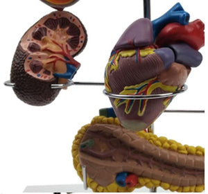 Modelo anatomia complicaciones diabetes 