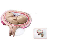 Kit de 8 modelos -  Desmontables del Desarrollo fetal embrionario - bebe y gemelos embarazo
