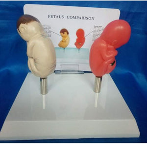 Modelo anatomico  feto comparativo fumados Vs saludable