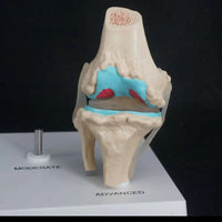 Anatomia degeneracion de rodilla - modelos anatomicos