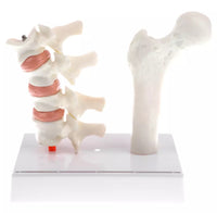 Modelo de Osteoporosis y morbilidad en el hueso femoral y vertebras
