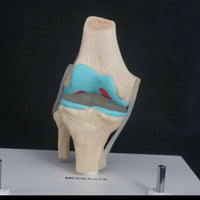 Anatomia degeneracion de rodilla - modelos anatomicos