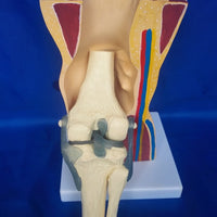 Modelo anatomico de rodilla