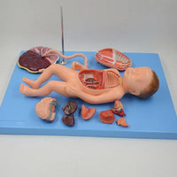 Modelo de Bebe Con Placenta nacimiento parto