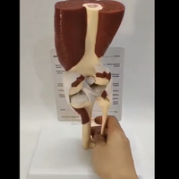 Modelo de articulación de hombro o rodilla con musculo