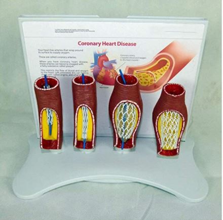 Modelo anatómico de corazón - enfermedad coronaria